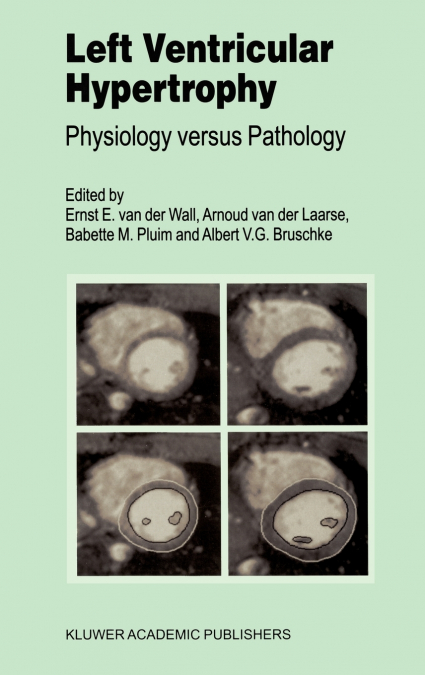 Left Ventricular Hypertrophy
