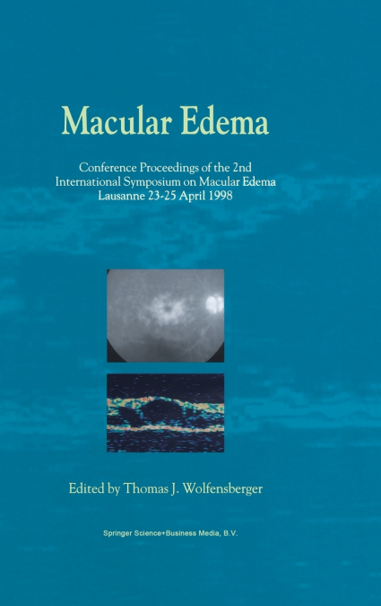 Macular Edema