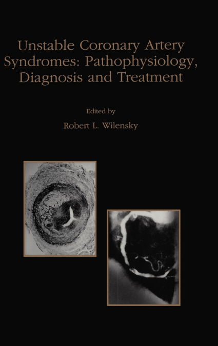 Unstable Coronary Artery Syndromes Pathophysiology, Diagnosis and Treatment