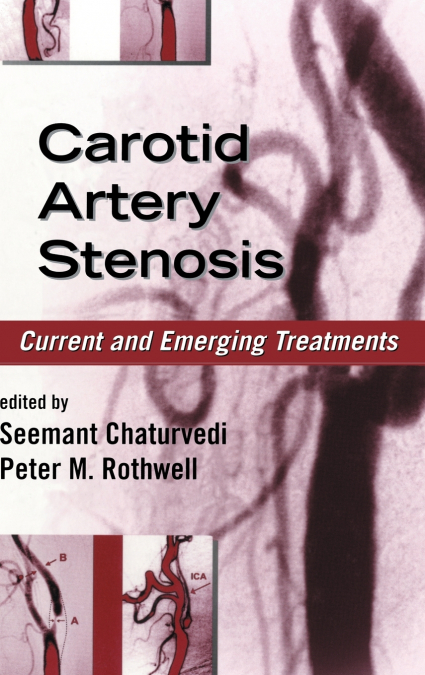Carotid Artery Stenosis