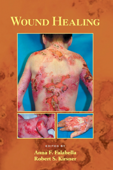 Wound Healing
