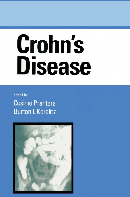 Crohn’s Disease