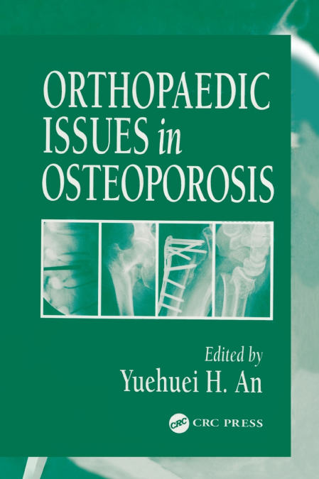 Orthopaedic Issues in Osteoporosis