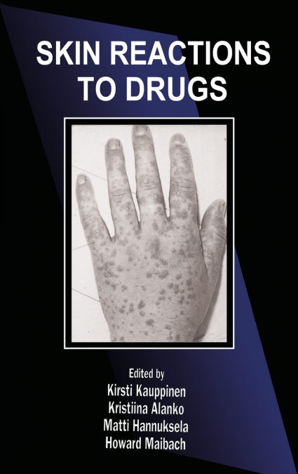 Skin Reactions to Drugs