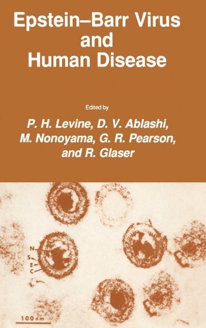 Epstein-Barr Virus and Human Disease