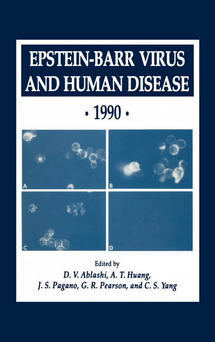 Epstein-Barr Virus and Human Disease · 1990