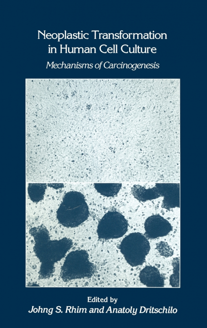 Neoplastic Transformation in Human Cell Culture