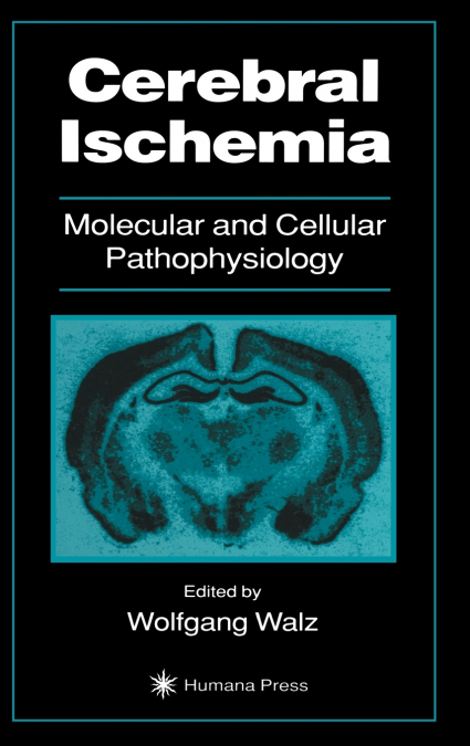 Cerebral Ischemia