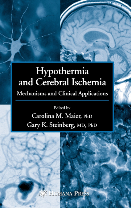Hypothermia and Cerebral Ischemia