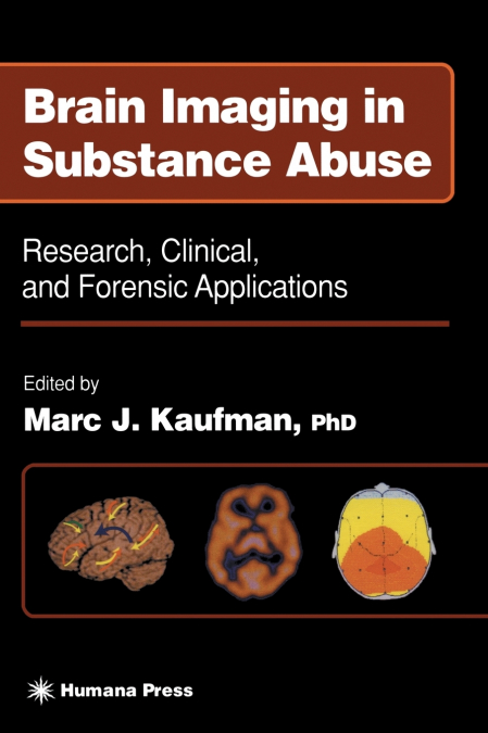 Brain Imaging in Substance Abuse