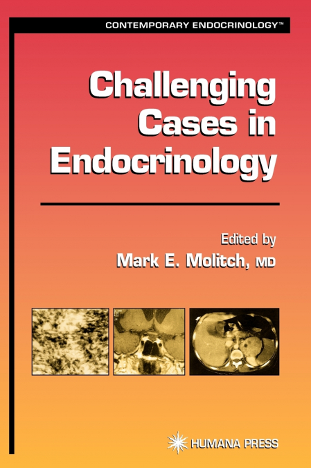 Challenging Cases in Endocrinology