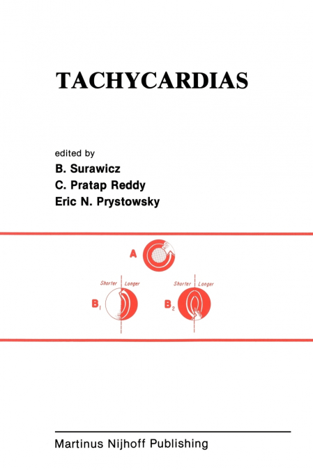 Tachycardias
