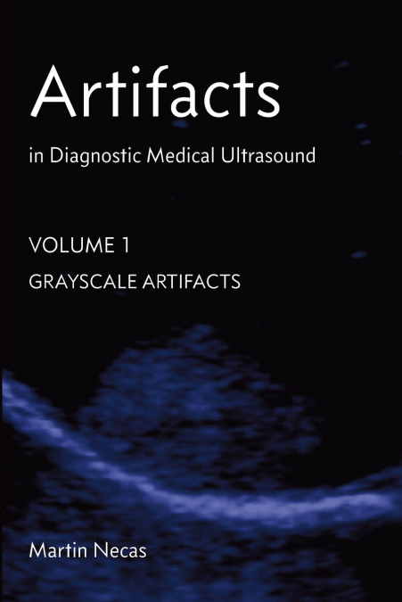 Artifacts in Diagnostic Medical Ultrasound