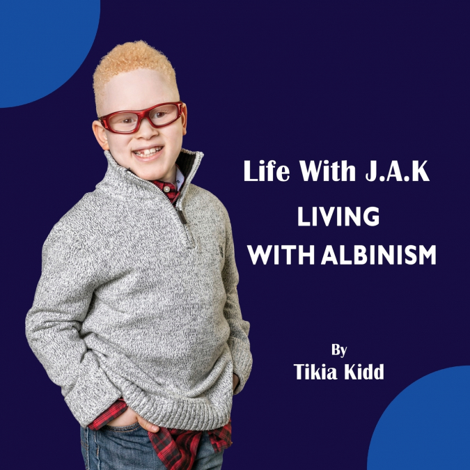 Life With J.A.K  Living with Albinism