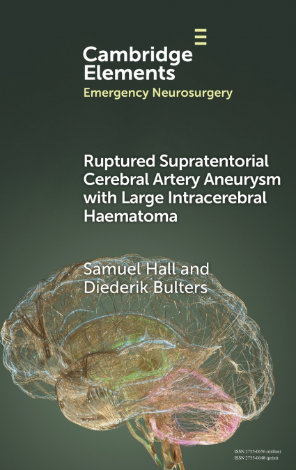 Ruptured Supratentorial Cerebral Artery Aneurysm with Large Intracerebral Haematoma