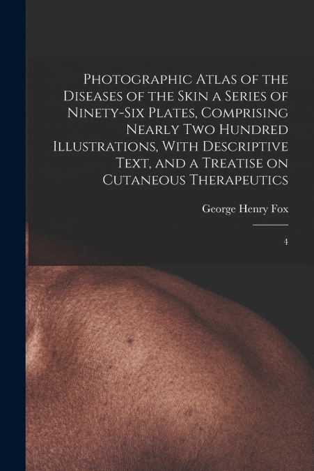 Photographic Atlas of the Diseases of the Skin a Series of Ninety-six Plates, Comprising Nearly two Hundred Illustrations, With Descriptive Text, and a Treatise on Cutaneous Therapeutics