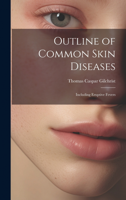 Outline of Common Skin Diseases