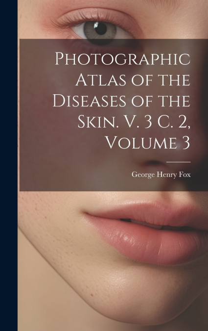 Photographic Atlas of the Diseases of the Skin. V. 3 C. 2, Volume 3