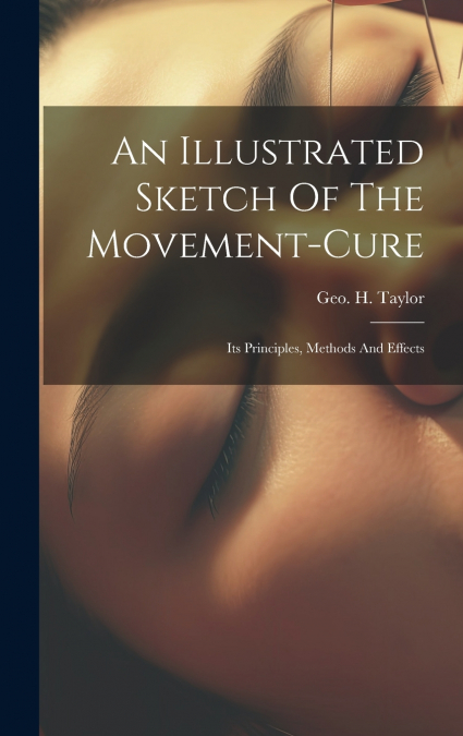 An Illustrated Sketch Of The Movement-cure