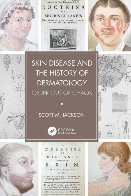 Skin Disease and the History of Dermatology