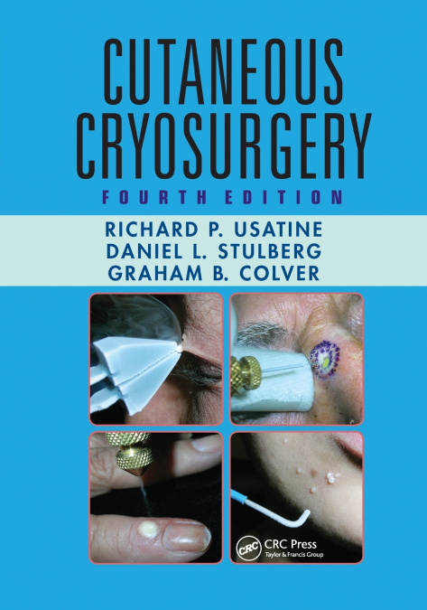 Cutaneous Cryosurgery
