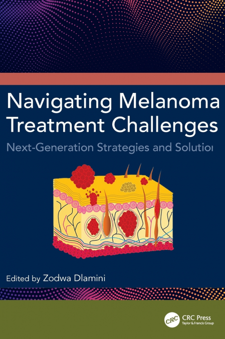 Navigating Melanoma Treatment Challenges