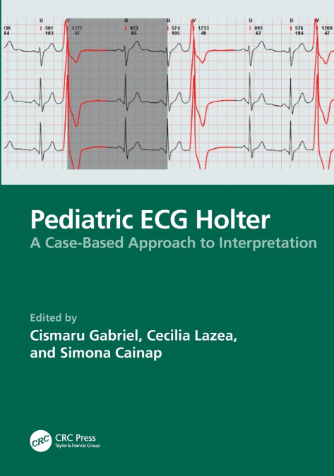 Pediatric ECG Holter