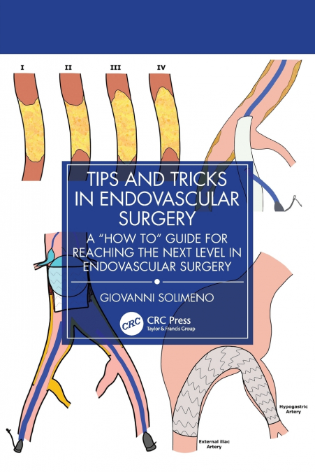 Tips and Tricks in Endovascular Surgery