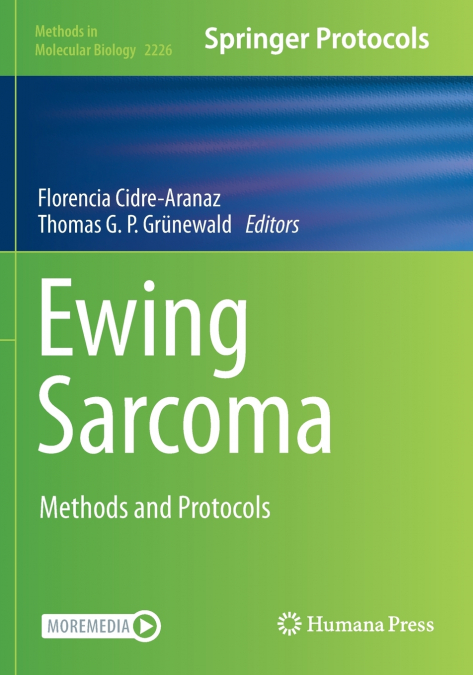 Ewing Sarcoma