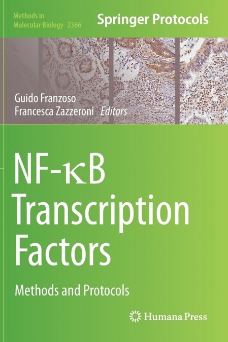 NF-κB Transcription Factors