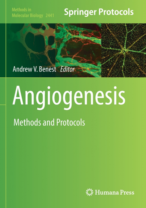 Angiogenesis