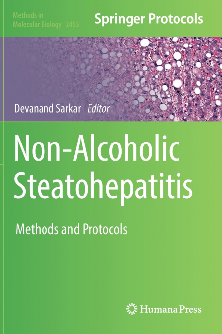 Non-Alcoholic Steatohepatitis