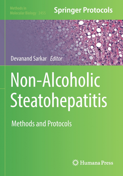 Non-Alcoholic Steatohepatitis