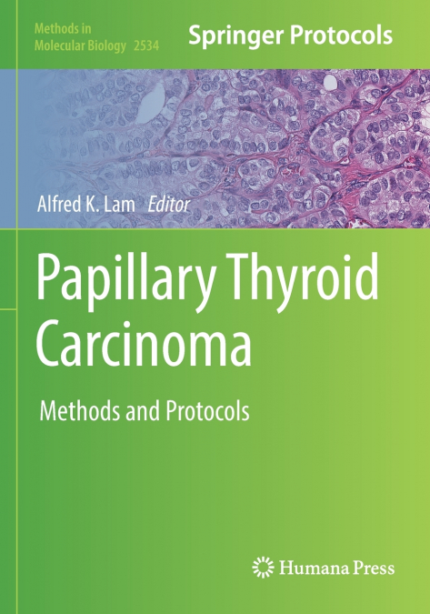 Papillary Thyroid Carcinoma