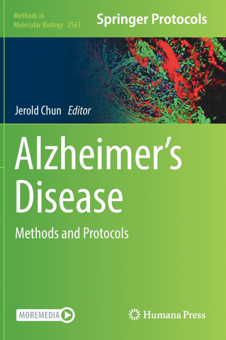 Alzheimer’s Disease