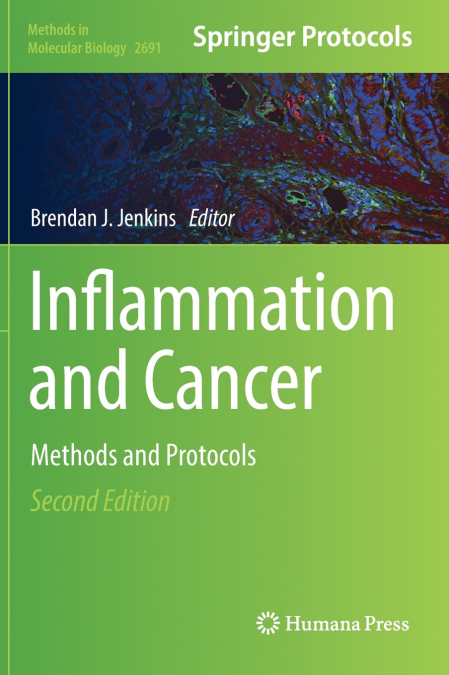 Inflammation and Cancer