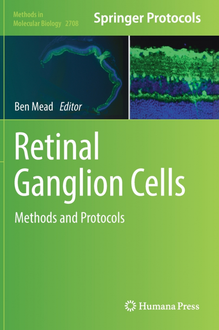 Retinal Ganglion Cells