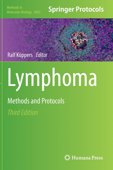 Lymphoma