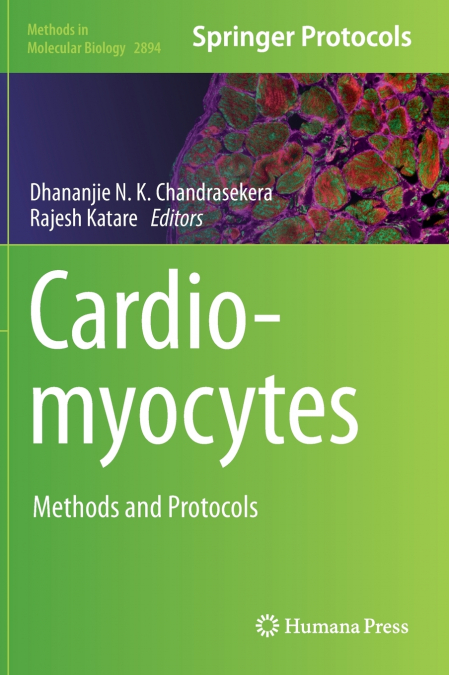Cardiomyocytes
