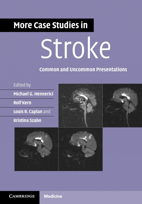 More Case Studies in Stroke