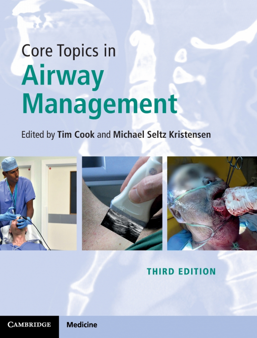 Core Topics in Airway Management