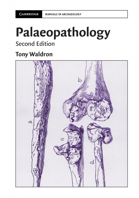 Palaeopathology
