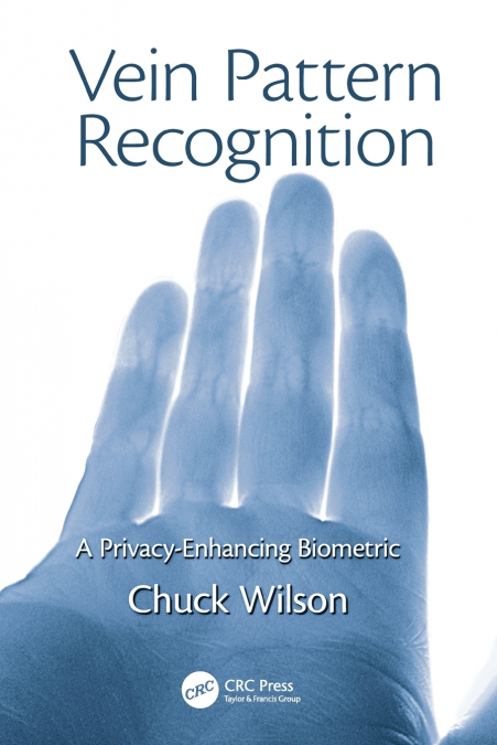 Vein Pattern Recognition