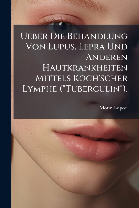 Ueber Die Behandlung Von Lupus, Lepra Und Anderen Hautkrankheiten Mittels Koch’scher Lymphe ('Tuberculin').