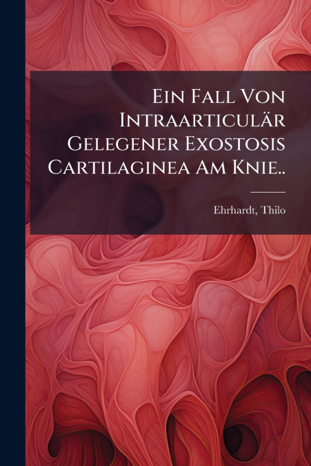Ein Fall Von Intraarticulär Gelegener Exostosis Cartilaginea Am Knie..