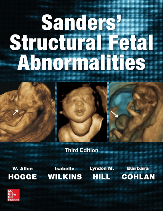 Sanders’ Structural Fetal Abnormalities, Third Edition