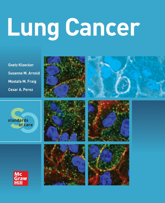 Lung Cancer