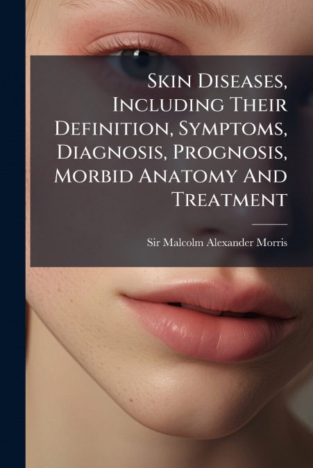 Skin Diseases, Including Their Definition, Symptoms, Diagnosis, Prognosis, Morbid Anatomy And Treatment