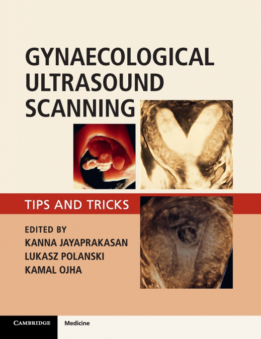 Gynaecological Ultrasound Scanning