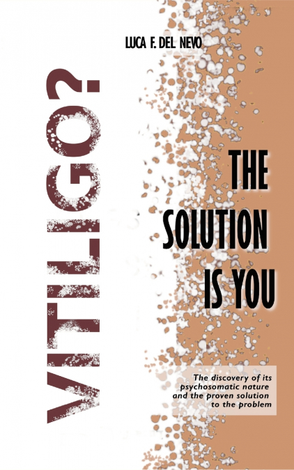 Vitiligo? The solution is you